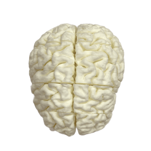 Alzheimer
